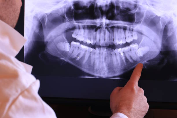 Best After-Hours Emergency Dentist in Frankfort, KY