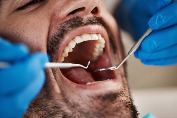 Best Emergency Orthodontic Repairs in Frankfort, KY