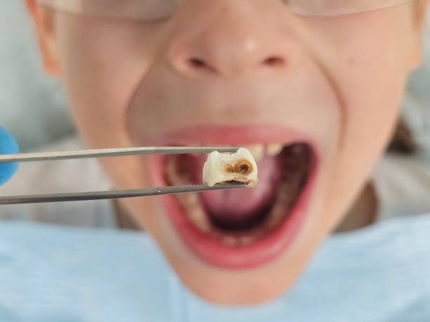 Best Walk-In Emergency Dentist in Frankfort, KY